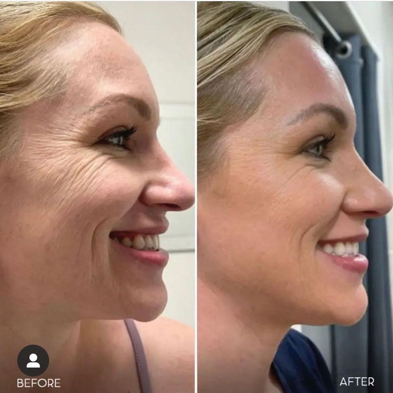 Victoria L., 39