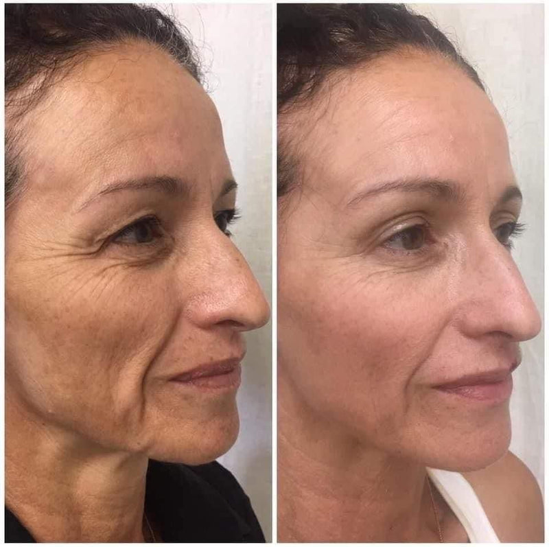 Elena R., 43